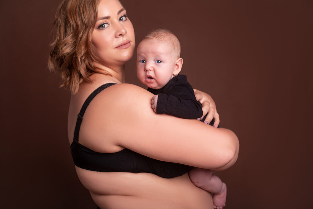 body contouring post baby mom bod Chicago